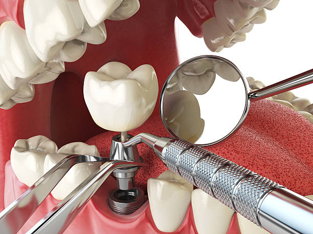 Best Emergency Gum Treatment in Pea Ridge, FL